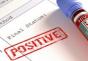 HIV testi pozitif