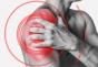 Choroba okołostawowa kości ramiennej: objawy i leczenie