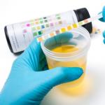 Splošna analiza urina - indikatorji, norma