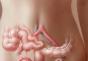 HPV cysta a oneskorenie menštruácie Podstata patológie, jej príčiny