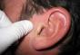 Clotrimazole solution for external use of ears