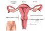 Qué es la inversión uterina: causas, síntomas, cómo tratar la patología Tratamiento de la inversión uterina