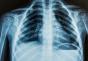How to read x-rays of the lungs, spine, sinuses