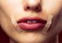 Užstrigimo ant lūpų atsiradimo priežastys ir gydymo metodai