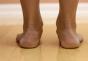 Gydytojas Komarovskis apie pėdos ir plokščių pėdų valgus deformaciją