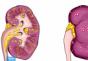 Muške bolesti u urologiji: simptomi Najbolja klinika za urologiju