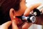 Otosclerosis: symptoms and treatment methods Otosclerosis cochlear form treatment
