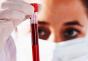 PCR en sangre: ¿qué es?