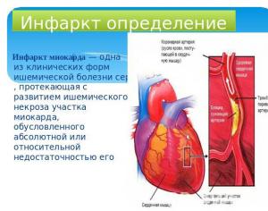 Prvi znaki srčnega infarkta pri moških