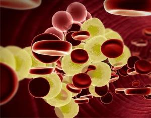 Ako liečiť vysokú hladinu cholesterolu v krvi